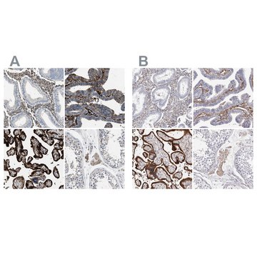 Anti-TGM2 antibody produced in rabbit Prestige Antibodies&#174; Powered by Atlas Antibodies, affinity isolated antibody, buffered aqueous glycerol solution