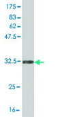 Monoclonal Anti-OCRL antibody produced in mouse clone 4A6, purified immunoglobulin, buffered aqueous solution