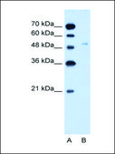 Anti-SLC2A6 antibody produced in rabbit IgG fraction of antiserum