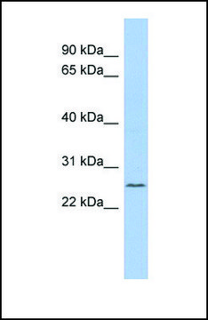 Anti-C11ORF53 antibody produced in rabbit affinity isolated antibody