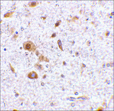 抗-TSLP (ab3) 兔抗 affinity isolated antibody