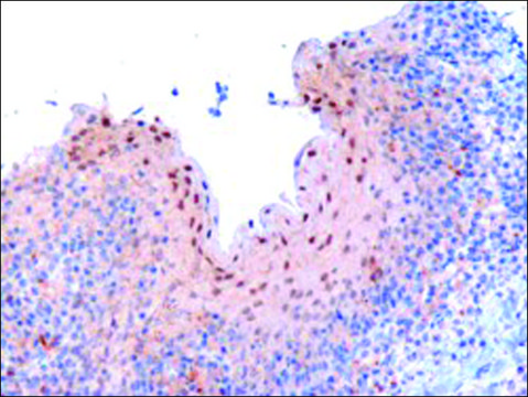 Anti-RANBPM/RANBP9 antibody produced in goat affinity isolated antibody, buffered aqueous solution