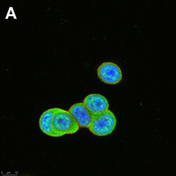 Anti-phospho-ULK1-Ser555 Antibody, clone 1E17 ZooMAb&#174; Rabbit Monoclonal recombinant, expressed in HEK 293 cells