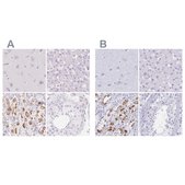 Anti-KCNE2 antibody produced in rabbit Prestige Antibodies® Powered by Atlas Antibodies, affinity isolated antibody, buffered aqueous glycerol solution