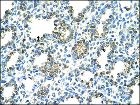 Anti-TST antibody produced in rabbit affinity isolated antibody