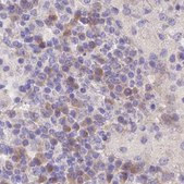 Anti-FAM168B antibody produced in rabbit Prestige Antibodies® Powered by Atlas Antibodies, affinity isolated antibody, buffered aqueous glycerol solution