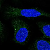 Anti-ALG9 antibody produced in rabbit Prestige Antibodies® Powered by Atlas Antibodies, affinity isolated antibody, buffered aqueous glycerol solution