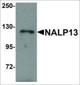 Anti-NALP13 antibody produced in rabbit affinity isolated antibody, buffered aqueous solution
