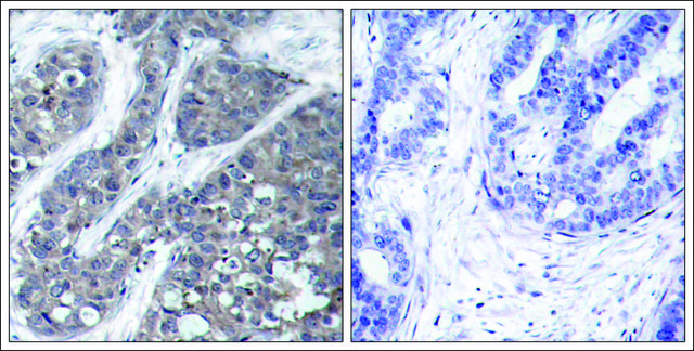 Anti-PTK2B (Ab-402) antibody produced in rabbit affinity isolated antibody