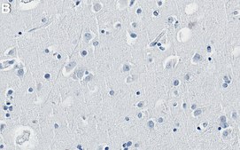 Anti-Rab10 Antibody, clone 1G2 ZooMAb® Rabbit Monoclonal recombinant, expressed in HEK 293 cells