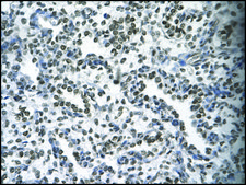 Anti-HOXB9 antibody produced in rabbit affinity isolated antibody