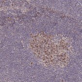 Anti-RGS14 antibody produced in rabbit Prestige Antibodies® Powered by Atlas Antibodies, affinity isolated antibody, buffered aqueous glycerol solution