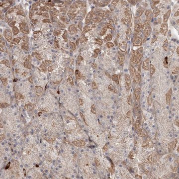 Anti-DHRS9 antibody produced in rabbit Prestige Antibodies&#174; Powered by Atlas Antibodies, affinity isolated antibody, buffered aqueous glycerol solution