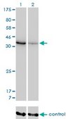 Monoclonal Anti-AKR1D1 antibody produced in mouse clone 1C2, purified immunoglobulin, buffered aqueous solution