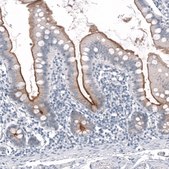 Anti-TMPRSS2 antibody produced in mouse Prestige Antibodies® Powered by Atlas Antibodies, clone CL12511, purified by using Protein A, buffered aqueous glycerol solution