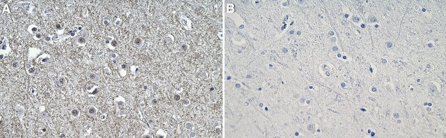 Anti-P2X7 Antibody, clone 1D23-1 ZooMAb&#174; Rabbit Monoclonal recombinant, expressed in HEK 293 cells