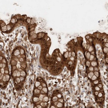 Anti-OTUD7B antibody produced in rabbit affinity isolated antibody, buffered aqueous glycerol solution