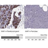 Anti-AAK1 antibody produced in rabbit Prestige Antibodies® Powered by Atlas Antibodies, affinity isolated antibody, buffered aqueous glycerol solution