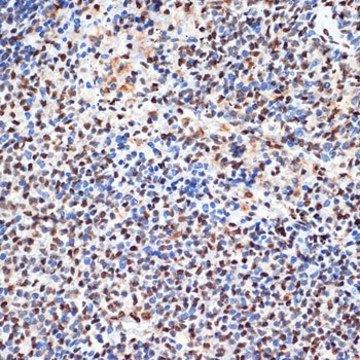 Anti-ANP32B antibody produced in rabbit