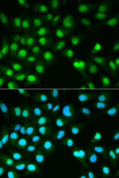 Anti-PPP3CA antibody produced in rabbit