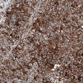 Anti-GSPT1 antibody produced in mouse Prestige Antibodies® Powered by Atlas Antibodies, clone CL13332, purified by using Protein A, buffered aqueous glycerol solution