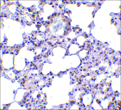 Anti-TRPC6 (ab2) antibody produced in rabbit affinity isolated antibody, buffered aqueous solution