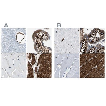 Anti-CALD1 antibody produced in rabbit Ab1, Prestige Antibodies&#174; Powered by Atlas Antibodies, affinity isolated antibody, buffered aqueous glycerol solution