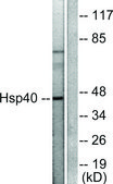 Anti-HSP40 antibody produced in rabbit affinity isolated antibody