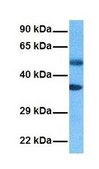 Anti-SLC19A3 antibody produced in rabbit affinity isolated antibody