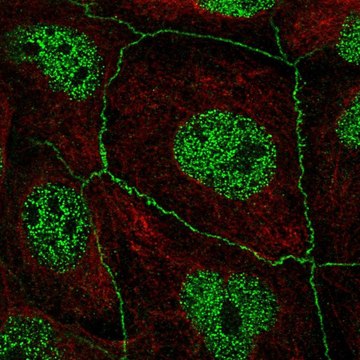 Anti-C16ORF59 antibody produced in rabbit Prestige Antibodies&#174; Powered by Atlas Antibodies, affinity isolated antibody, buffered aqueous glycerol solution