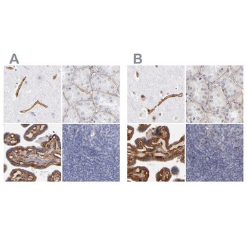 Anti-LAMC1 antibody produced in rabbit Ab2, Prestige Antibodies&#174; Powered by Atlas Antibodies, affinity isolated antibody, buffered aqueous glycerol solution