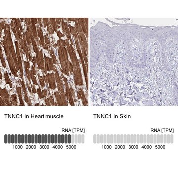 Anti-TNNC1 antibody produced in rabbit Prestige Antibodies&#174; Powered by Atlas Antibodies, affinity isolated antibody, buffered aqueous glycerol solution