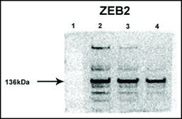 Anti-ZEB2 affinity isolated antibody