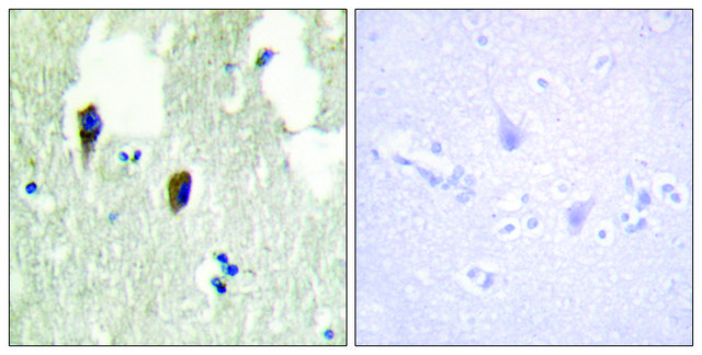 Anti-KLHL3 antibody produced in rabbit affinity isolated antibody