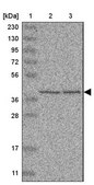 Anti-UROD antibody produced in rabbit Prestige Antibodies® Powered by Atlas Antibodies, affinity isolated antibody, buffered aqueous glycerol solution