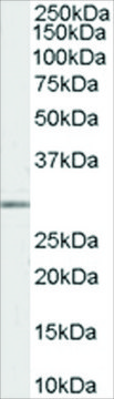 Anti-MMP7 antibody produced in goat affinity isolated antibody, buffered aqueous solution