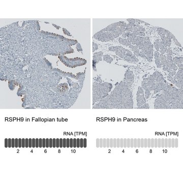 Anti-RSPH9 antibody produced in rabbit Prestige Antibodies&#174; Powered by Atlas Antibodies, affinity isolated antibody, buffered aqueous glycerol solution