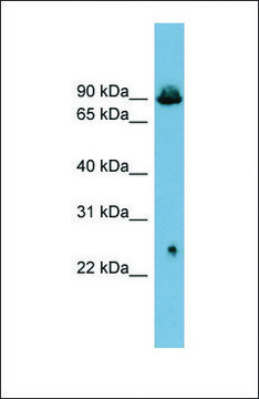 Anti-SLC6A5 antibody produced in rabbit affinity isolated antibody