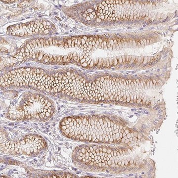 Anti-ACVR1B antibody produced in rabbit Prestige Antibodies&#174; Powered by Atlas Antibodies, affinity isolated antibody, buffered aqueous glycerol solution