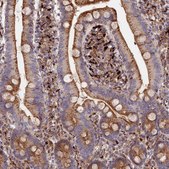 Anti-PPP2R3C antibody produced in rabbit Prestige Antibodies® Powered by Atlas Antibodies, affinity isolated antibody, buffered aqueous glycerol solution