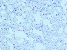 Anti-MR−Pro ADM antibody produced in rabbit
