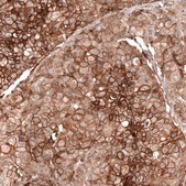 Monoclonal Anti-Fxyd5 Antibody Produced In Mouse Prestige Antibodies® Powered by Atlas Antibodies, clone CL14039, affinity isolated antibody, buffered aqueous glycerol solution