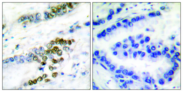 Anti-ERCC1 antibody produced in rabbit affinity isolated antibody