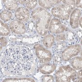 Anti-CYP4V2 antibody produced in rabbit Prestige Antibodies® Powered by Atlas Antibodies, affinity isolated antibody, buffered aqueous glycerol solution
