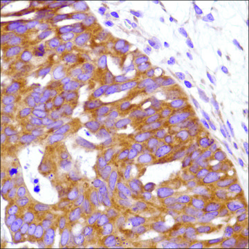 Anti-URI antibody, Rabbit monoclonal recombinant, expressed in proprietary host, clone SP215, affinity isolated antibody