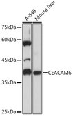 Anti-CEACAM6 Antibody, clone 4Z3V7, Rabbit Monoclonal