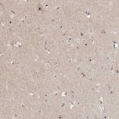 Anti-GNL3L antibody produced in rabbit Prestige Antibodies® Powered by Atlas Antibodies, affinity isolated antibody, buffered aqueous glycerol solution