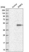 Anti-ZPBP2 antibody produced in rabbit Prestige Antibodies® Powered by Atlas Antibodies, affinity isolated antibody, buffered aqueous glycerol solution