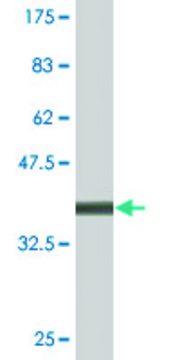 Monoclonal Anti-ATP7B, (C-terminal) antibody produced in mouse clone 3A12, purified immunoglobulin, buffered aqueous solution