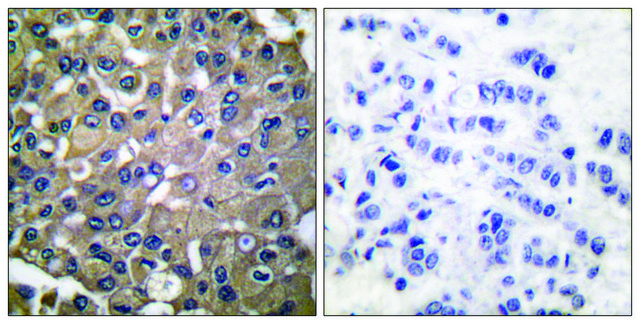 抗-MMP-9 兔抗 affinity isolated antibody